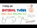 Different Types of Enteral Tubes - - NCLEX Nursing Review