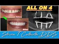 Fabulous All on 4 Dental Cases - Dental Minute with Steven T Cutbirth DDS