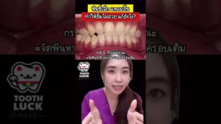  ฟันซี่หน้าเล็กเหมือนเม็ดข้าวโพดเกิดจากสาเหตุอะไร และมีวิธีรักษาอย่างไรบ้าง 