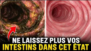 Le Meilleur laxatif POUR vider tous les déchets collés de vos intestins, perdez 3 kg vite!