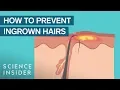 What Are Ingrown Hairs And How To Treat Them