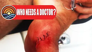 DIY Stitches! Who needs a doctor?? DRIFTING Ep. 07
