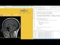 Exploring Fuzzy Logic for EEG Data Analysis Interactive Tools Live Debugging
