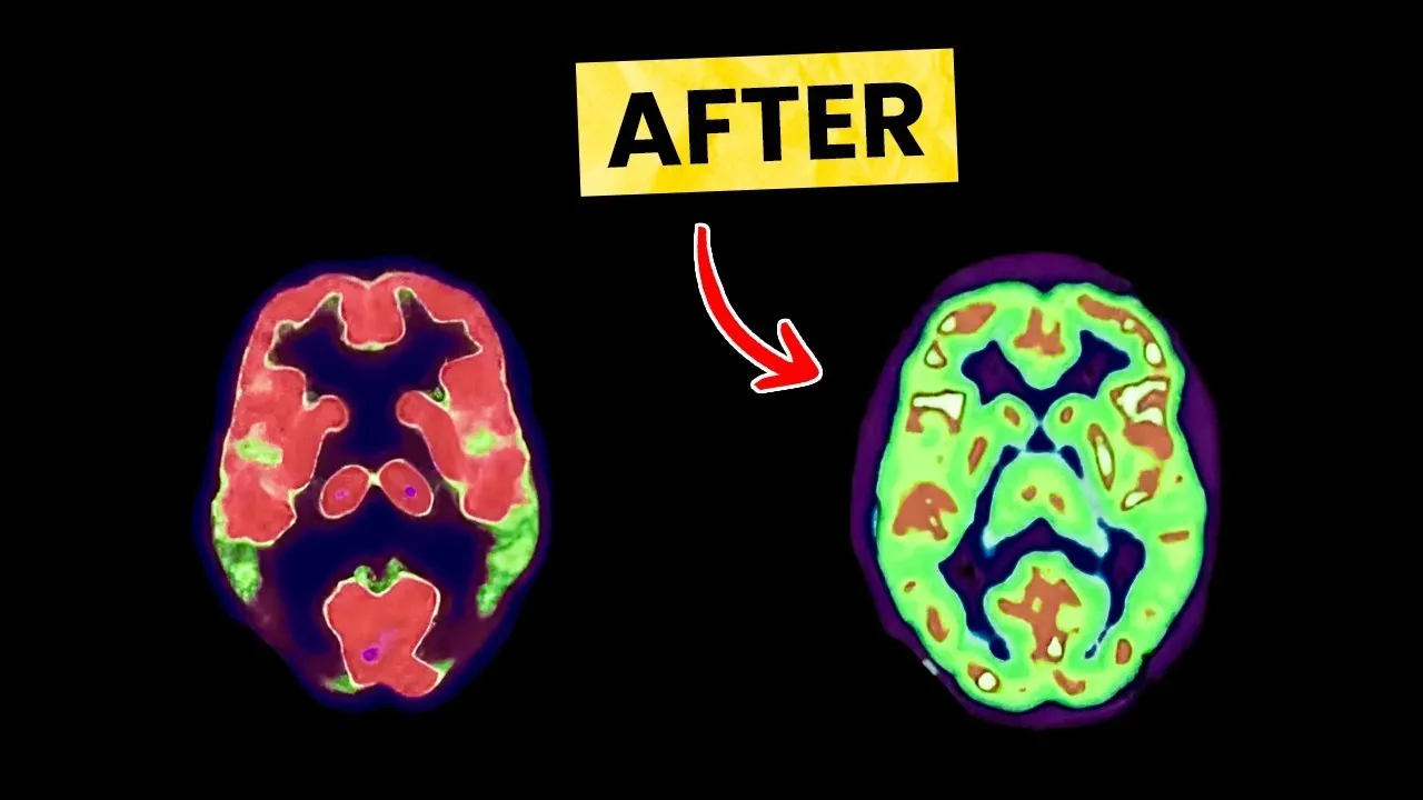 How To Trigger ADHD Hyperfocus Instantly