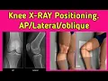 Knee Joint X-ray Positioning UdayXray