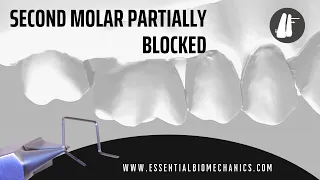 Second - molar