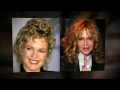 Melanie Griffith Plastic Surgery