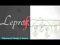 Algorithms 15 Data Structures Fibonacci Heaps part - 2 LE PROF