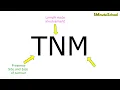 Download Lagu TNM Classification of Cancer