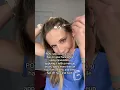 Use minoxidil like this to avoid growing hair on face and neck