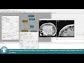 MeVisLab Tutorials - Visualization