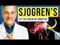 Download Lagu URGENT: REDUCE Brain Inflammation To Prevent Sjogren's Disease and Other AUTOIMMUNE DISEASES!