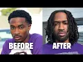 My One Year Loc Journey Tips and Tricks for Starter Locks