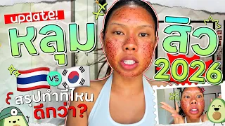 อัพเดทหลุมสิว 2026 สรุปทำที่ไหนปังกว่า ไทย vs เกาหลี ? | Alie