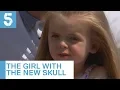 Ava Carlin 3 shows off her new head following 9 hour surgery 5 News