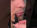 Mustache enhancement