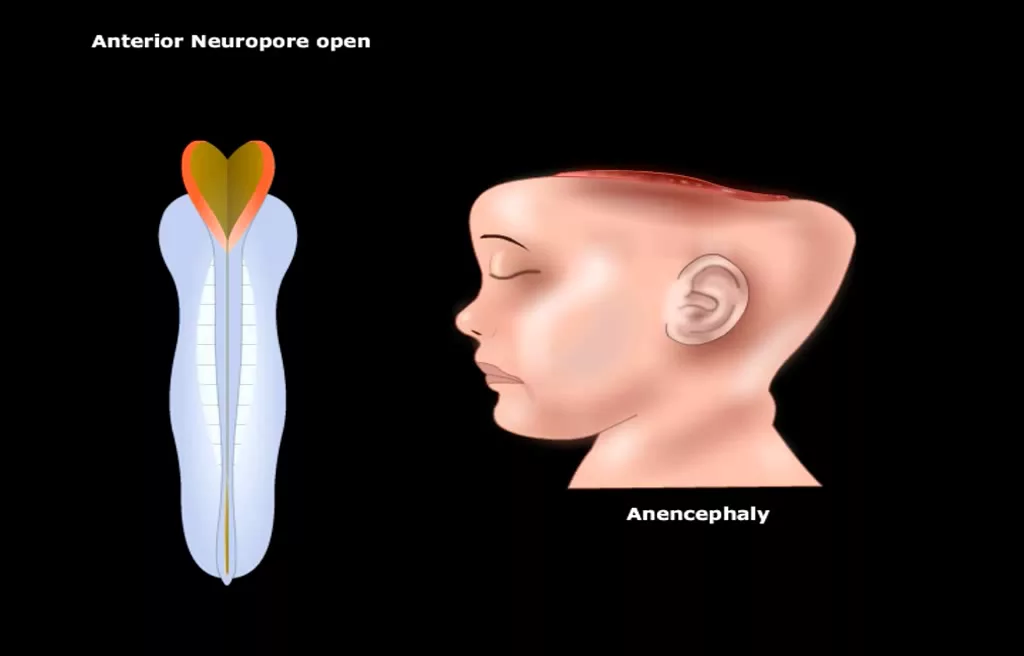 USMLE® Step 1: Neuroscience: Development of CNS Animation