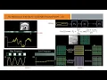 DCT 2D COMPRESSION