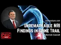 Derrick Connell - Unremarkable MRI Findings in Spine Trail