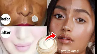 Starch And Yogurt By God Then By God It Will Whiten The Face Forever How To Get Skin As White 
