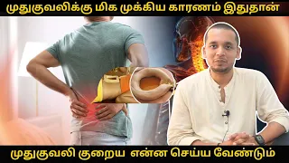 முதுகுவலி இளம்வயதில் ஏற்பட காரணம் என்ன? |  முதுகுவலி குறைய  என்ன செய்ய வேண்டும் | Easy Tips Backpain