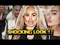 Darcey Silva Shocks Fans With Alien Face Following New Plastic Surgery