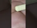 what a real xanax bar looks like For education purposes to prevent buying fakes