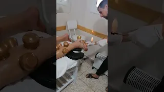 الحجامة العلاحية لمشاكل اسفل القدم بطنجة وتطوان 0641454959 Tanger Tetouan Hijama 