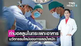 การใส่บอลลูนในกระเพาะอาหารช่วยลดน้ำหนักได้อย่างไร