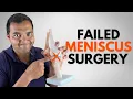 5 Ways To Tell You Might Unfortunately Have A Failed Meniscus Surgery