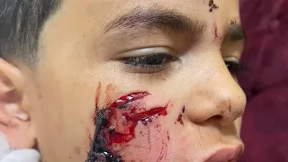 ٢٤ ديسمبر  ٢٠٢٢ كلب مسعور في الشارع يهاجم الناس والأطفال اكتر خلي بالك من عيالكم دندنها