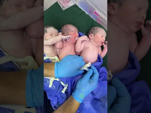 Babies cord clamping