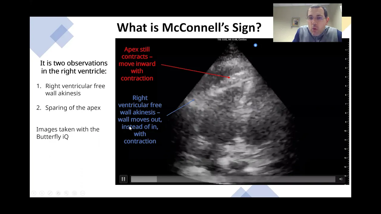 McConnell's Sign