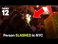 23-year-old slashed in head and arm in Brooklyn man charged