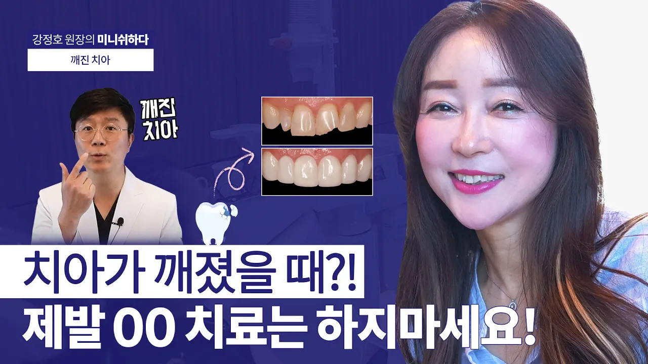 깨진 치아 손상에 따라 달라지는 치과 치료ㅣ미니쉬, 크라운, 라미네이트