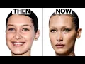 What Happened to Bella Hadid s Face Plastic Surgeon Reacts