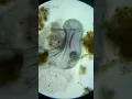 HUGE CELL BURSTS UNDER MICROSCOPE