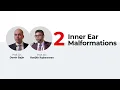 Inner Ear Malformations