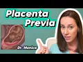 Placenta Previa OBGYN Shares Everything You Need to Know
