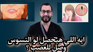 ايه اللي هيحصل لما التسوس يوصل للعصب وايه الحل التجمع الخامس المهندسين د عبدالسلام محمد 
