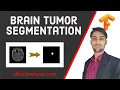 Brain Tumor Segmentation UNET Segmentation in Keras TensorFlow Medical Image Segmentation