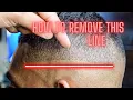 Download Lagu EASIEST WAY TO REMOVE A BALD GUIDELINE!