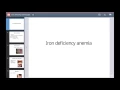 Download Lagu Iron deficiency anemia  فقر الدم نتيجة نقص الحديد