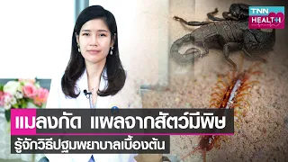  ถ้าโดนผึ้งหรือต่อแตนกัดหรือต่อย จะต้องทำอย่างไรบ้าง 