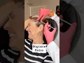 Download Lagu Migraine Botox #drbitafarrell #botox #naturalaestheticscenter #migraine