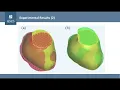 Active Surface for Fully 3D Automatic Segmentation
