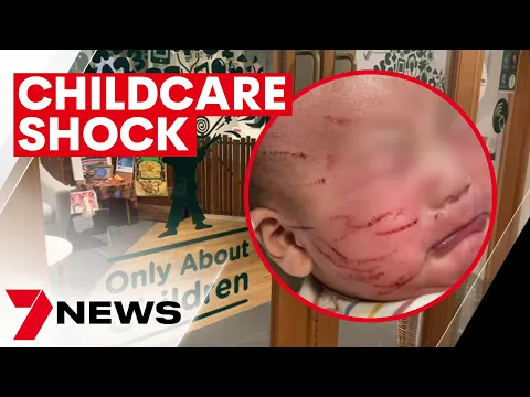 Download MP3 A childcare shock – the pictures a mum wants you to see | 7NEWS