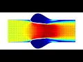 2D Fluid-Structure Interaction FSI Simulation of Aortic Valve Using COMSOL Multiphysics