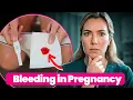 Does my bleeding mean MISCARRIAGE Bleeding in Pregnancy Understanding the Signs