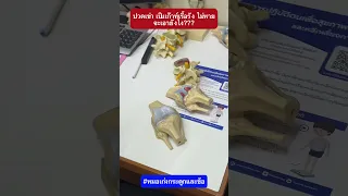  เก๊าทมีผลต่อข้อเข่าอย่างไร และเกิดจากสาเหตุอะไรบ้าง 